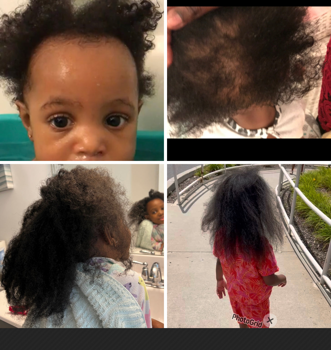 Flourish: Hair growth and scalp stimulator