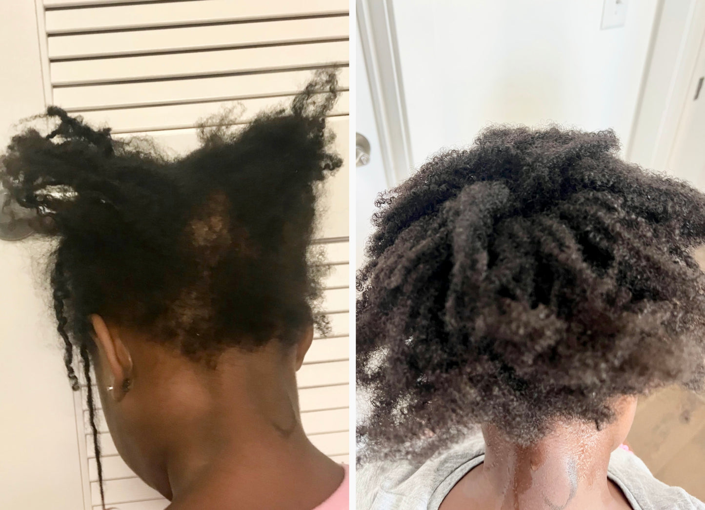 before and after