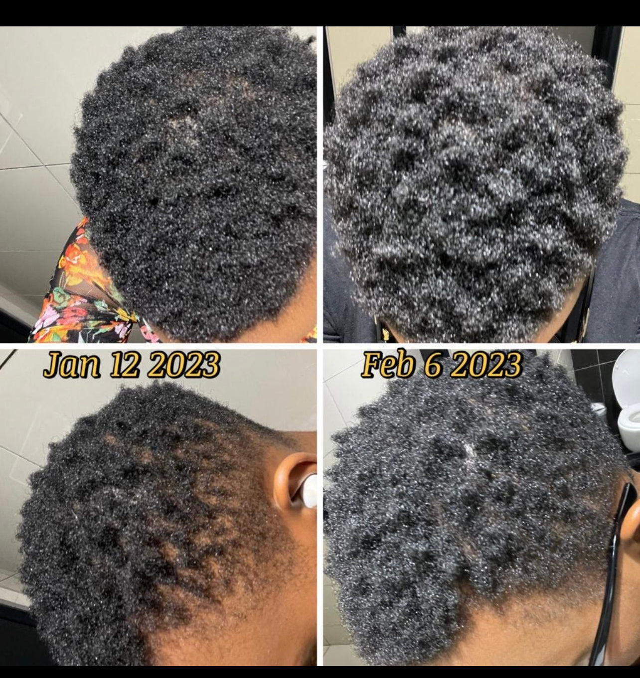 Flourish: Hair growth and scalp stimulator